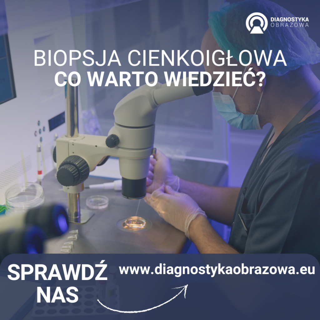 Biopsja cienkoigłowa co warto wiedzieć (1)